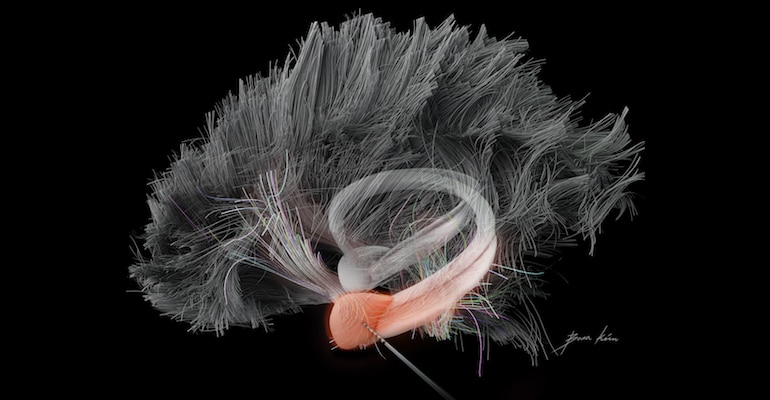 amygdala illustration on black
