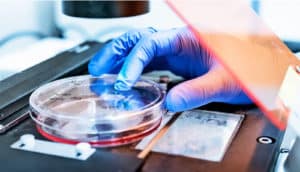 petri dish on microscope