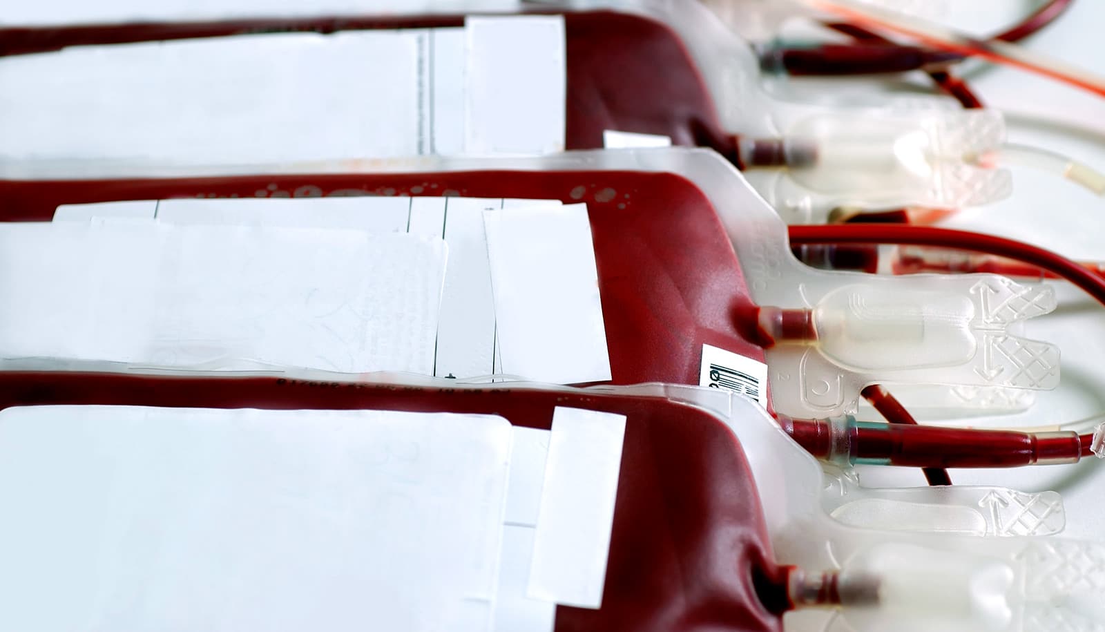 Policy puts some African blood banks too far away Futurity