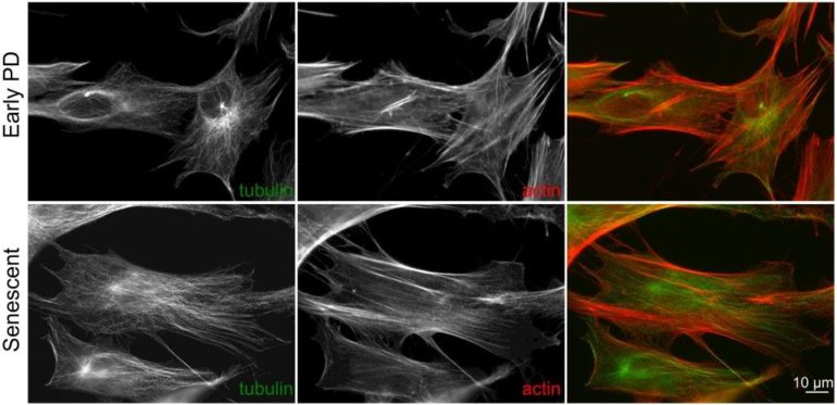 aging cells