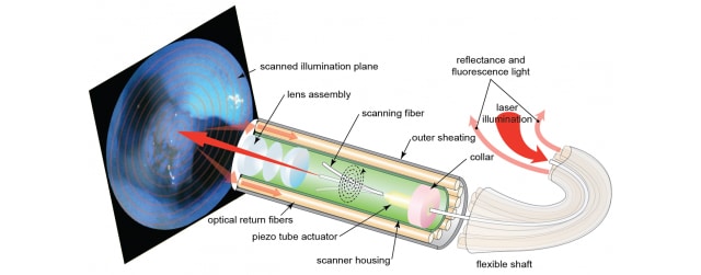 endoscope diagram