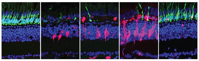 regeneration of retina cells