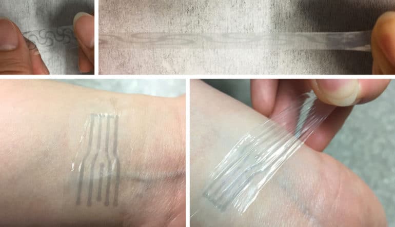 electrode pattern on polymer on skin