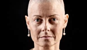 woman undergoing chemo