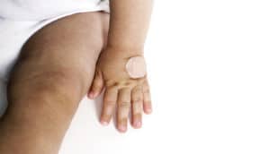 baby's hand with bandaid on white