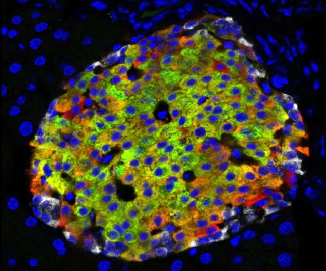 insulin-producing cells 