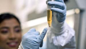 HIV-infected cells in vial