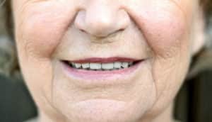 woman's neutral mouth