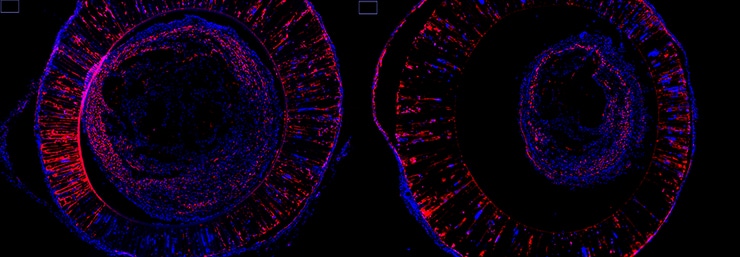 nerve regrowth method comparison