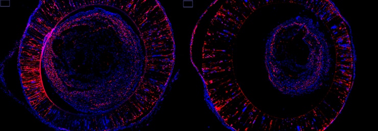 nerve regrowth method comparison