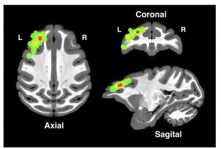 locations in the dorsolateral prefrontal cortex