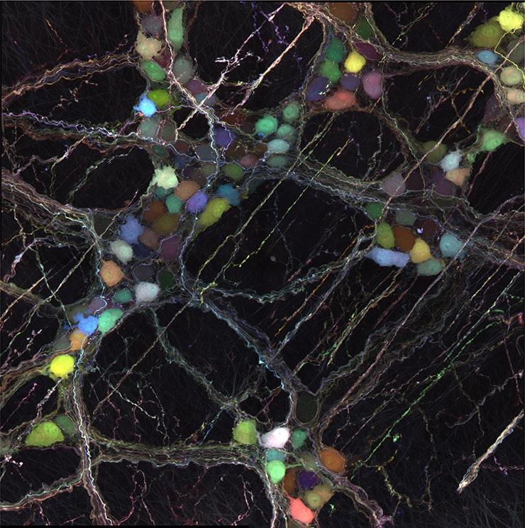 virus labels enteric nervous system