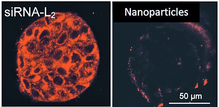 Microscopy photo of a tumor sample