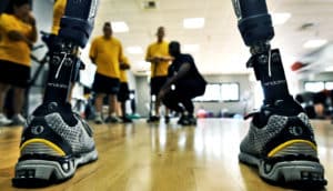 athlete with prosthetic legs