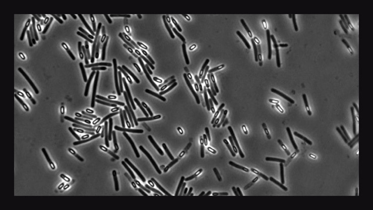 <em>C. diff</em> under a microscope