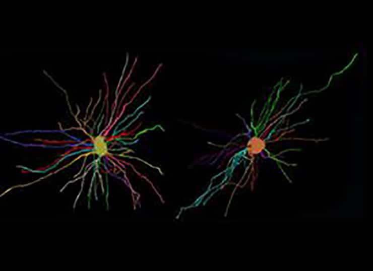 glial schizophrenia astrocyte