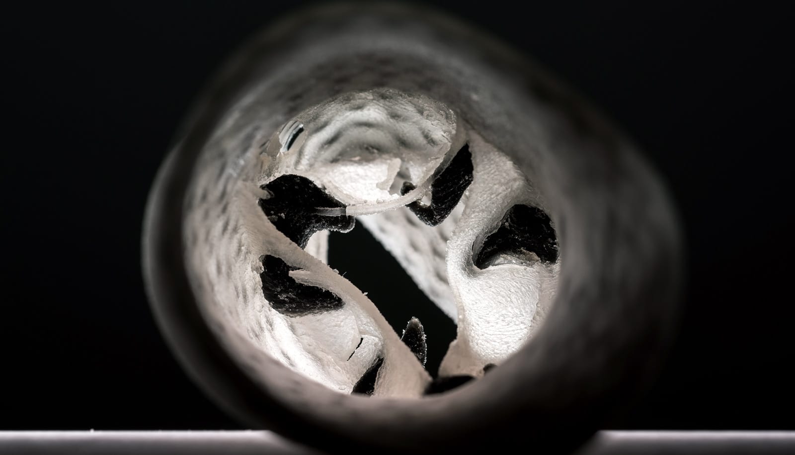 Inside the 3D-printed model of a human heart valve, black regions represent the location of actual calcium deposits.