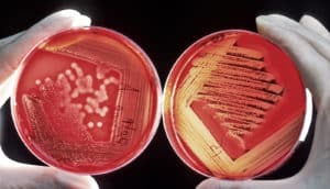 strep bacteria on two red agar plates