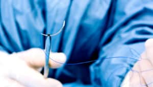 hand holds suturing needle and thread