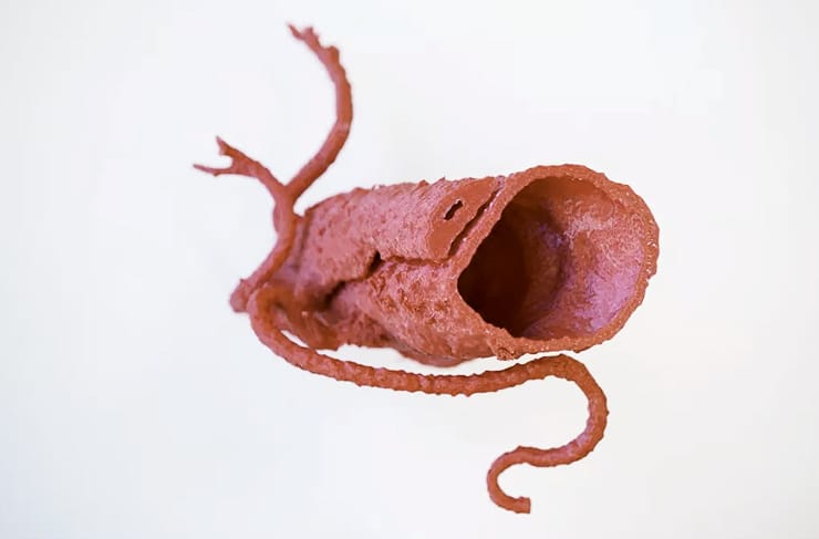 3d-printed aorta