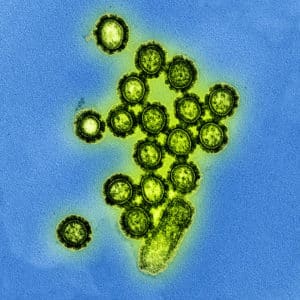 h1n1 flu strain particles