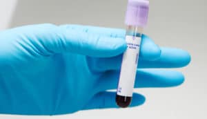 hand wearing medical glove holds a test tube