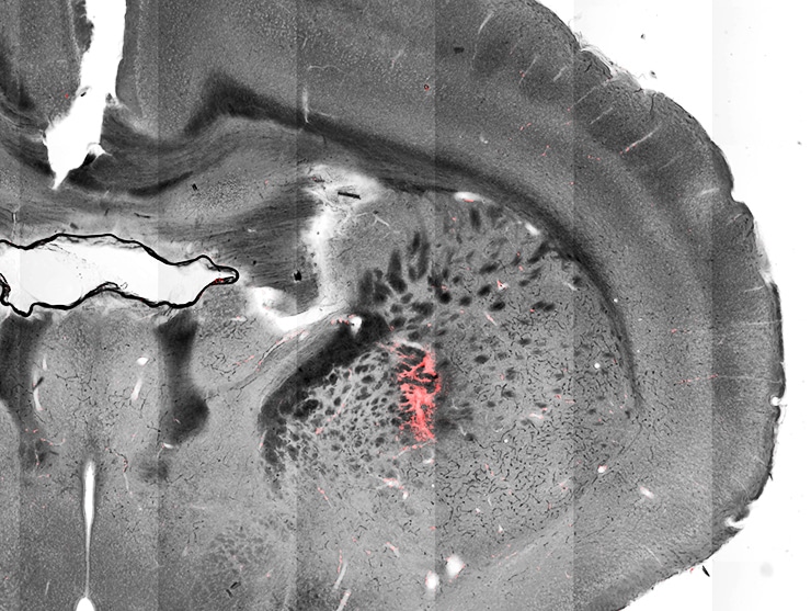 magnetic nanoparticles in the brain