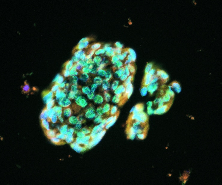 lung spheroid cells