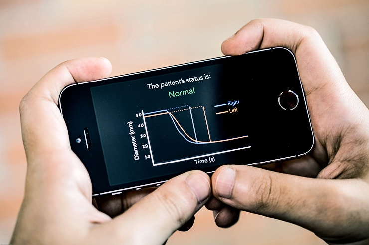 PupilScreen normal output