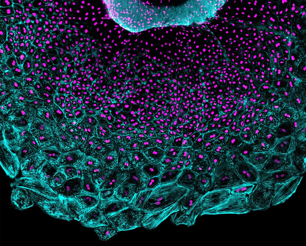 heart regeneration in zebrafish