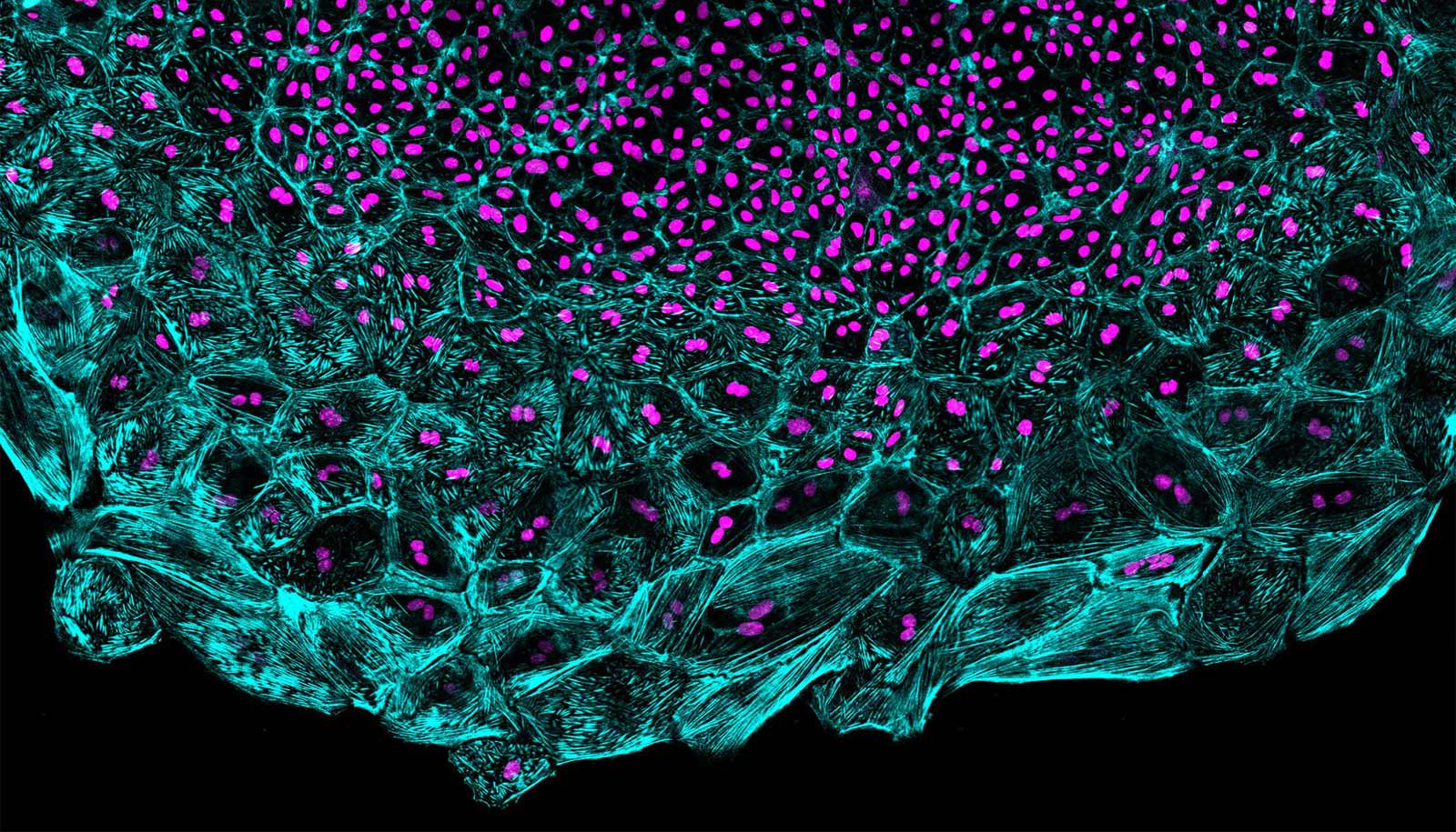 Supersized cells lead 'wave' of heart regeneration - Futurity