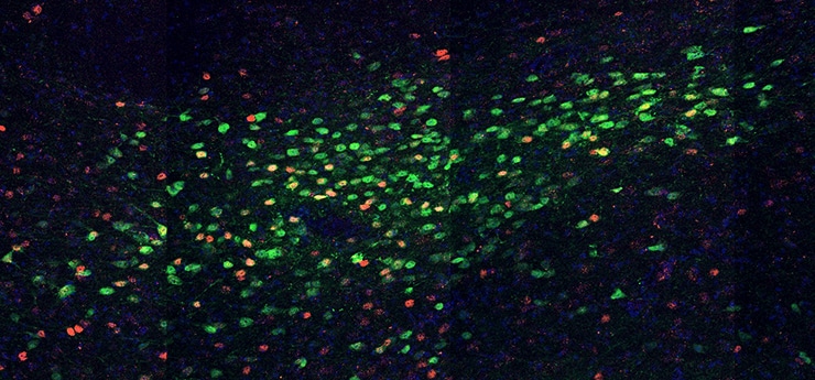 neurons in the zona incerta