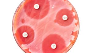 bacteria in pink petri dish