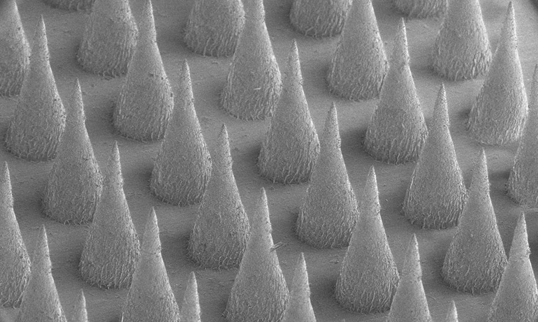 microneedle patch
