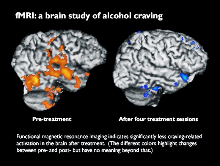 fMRI imaging of craving