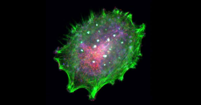 melanoma cell