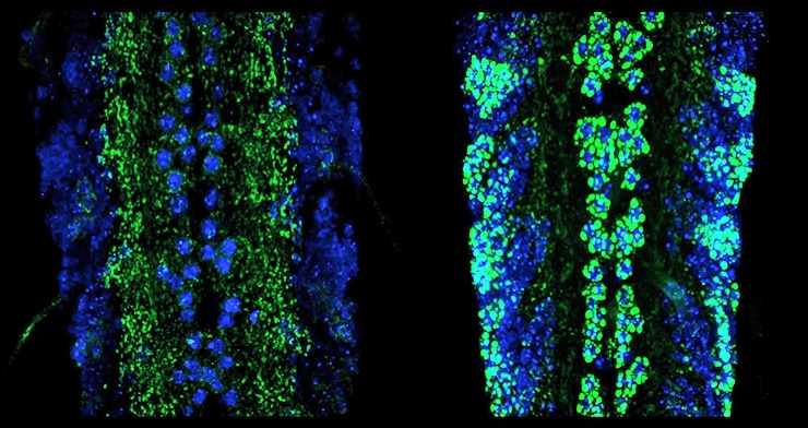 nerve cords