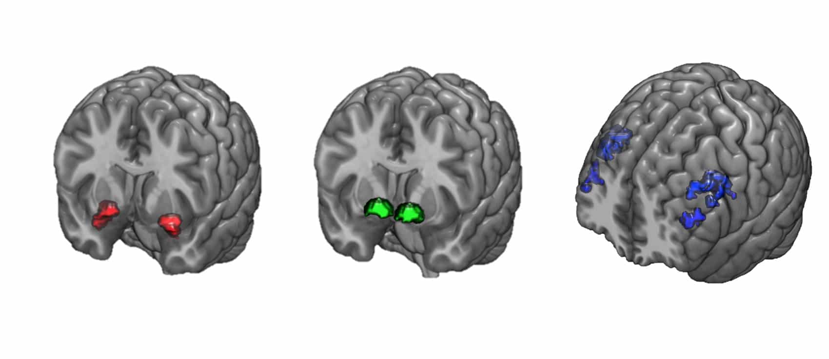 three brain diagrams