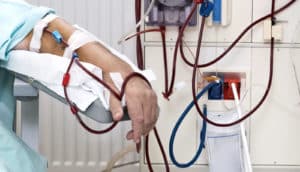 person who needs kidney during dialysis
