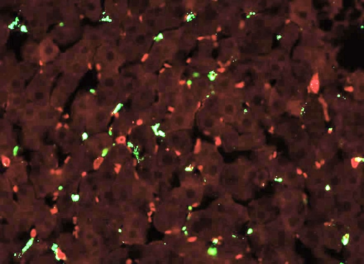 nanoparticles and neutrophils