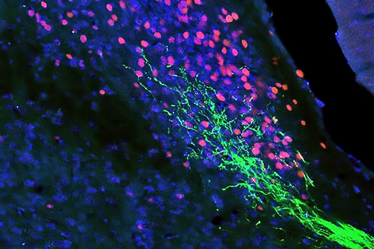 trigeminal neurons