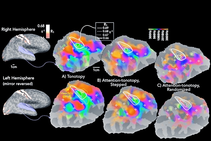 brain and sound 