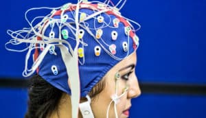 EEG cap (seizures, epilepsy, + artificial intelligence)