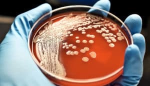 petri dish (pathogens + resistance concept)