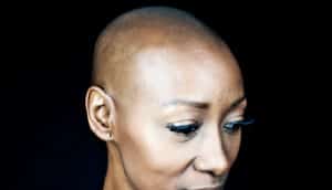 woman against black background (glioblastoma concept)