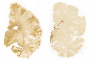 Brain comparison