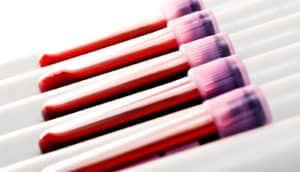 vials of blood on a slant