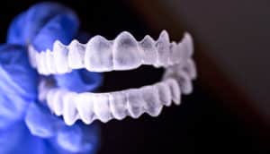 invisalign-style teeth mold