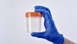 medical sample cup (HIV test concept)