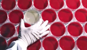 gloved hand and red petri dishes